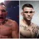 Michael Chandler UFC 257 Frontkick.online