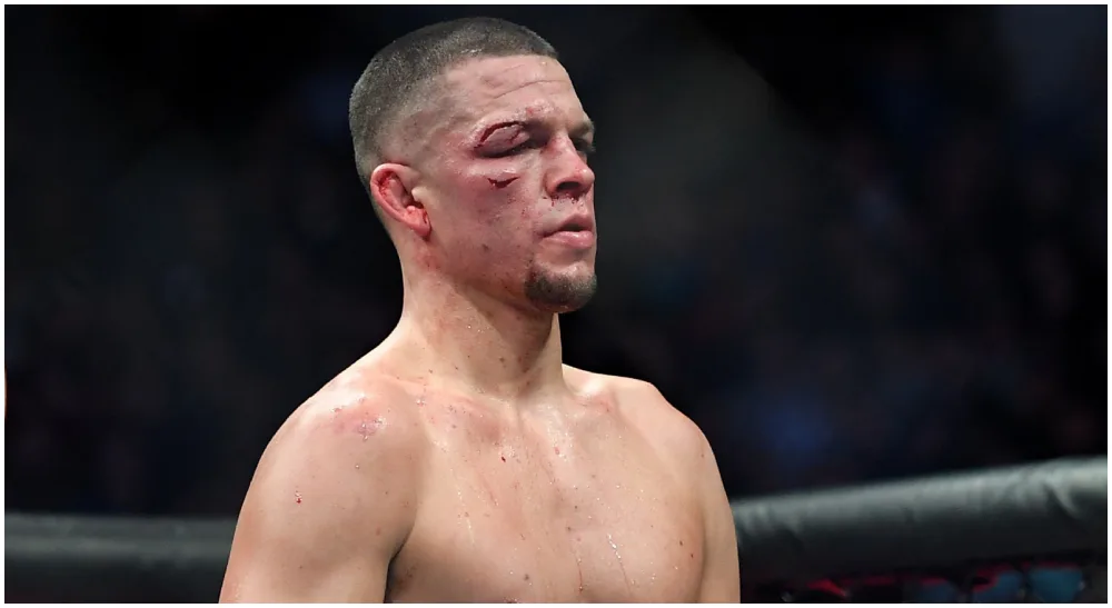 Nate Diaz MMA 1 Frontkick.online