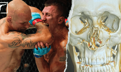 Andreas Gustafsson 2 DWCS MMA Frontkick.online