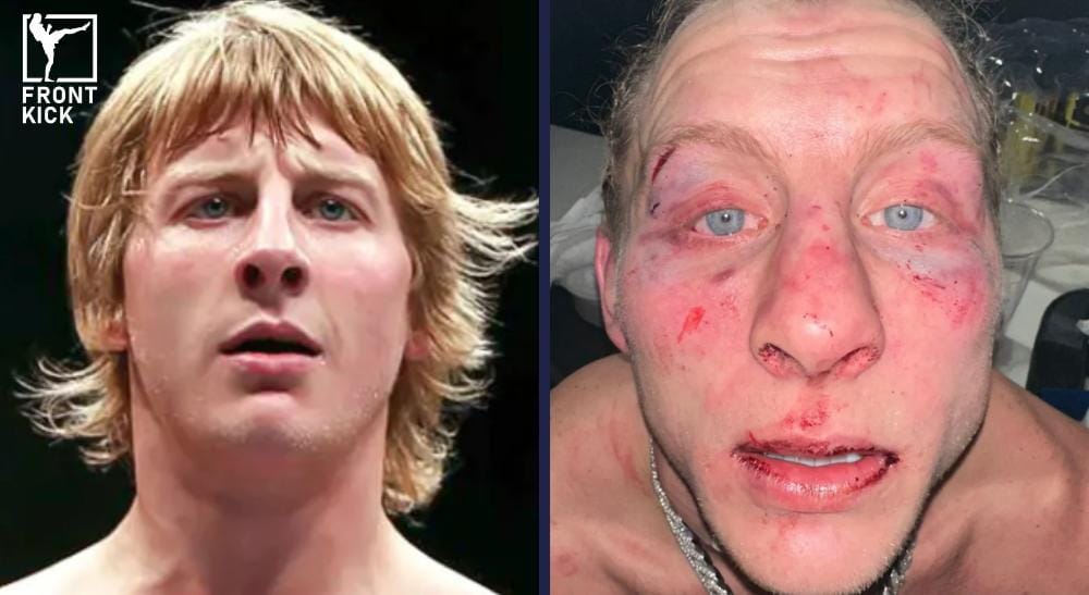 Paddy Pimblett UFC 324 Frontkick.online (1)