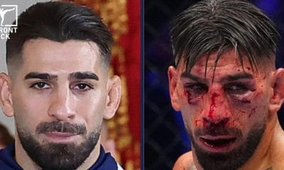 Hur skadad blev Ilia Topuria Frontkick