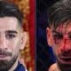 Hur skadad blev Ilia Topuria Frontkick