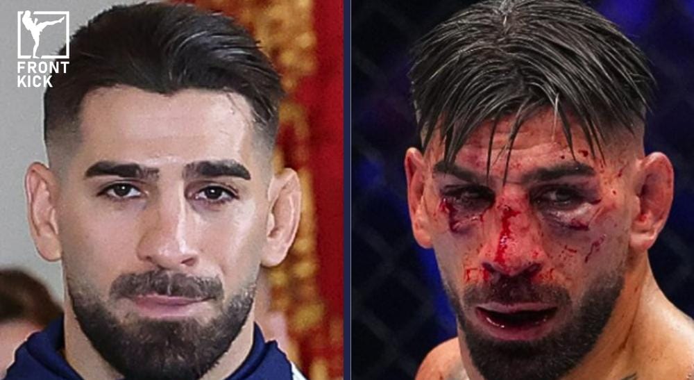 Hur skadad blev Ilia Topuria Frontkick